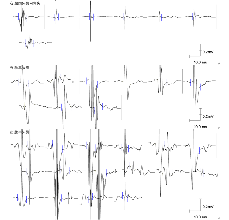 1690425232488260.png 115.png